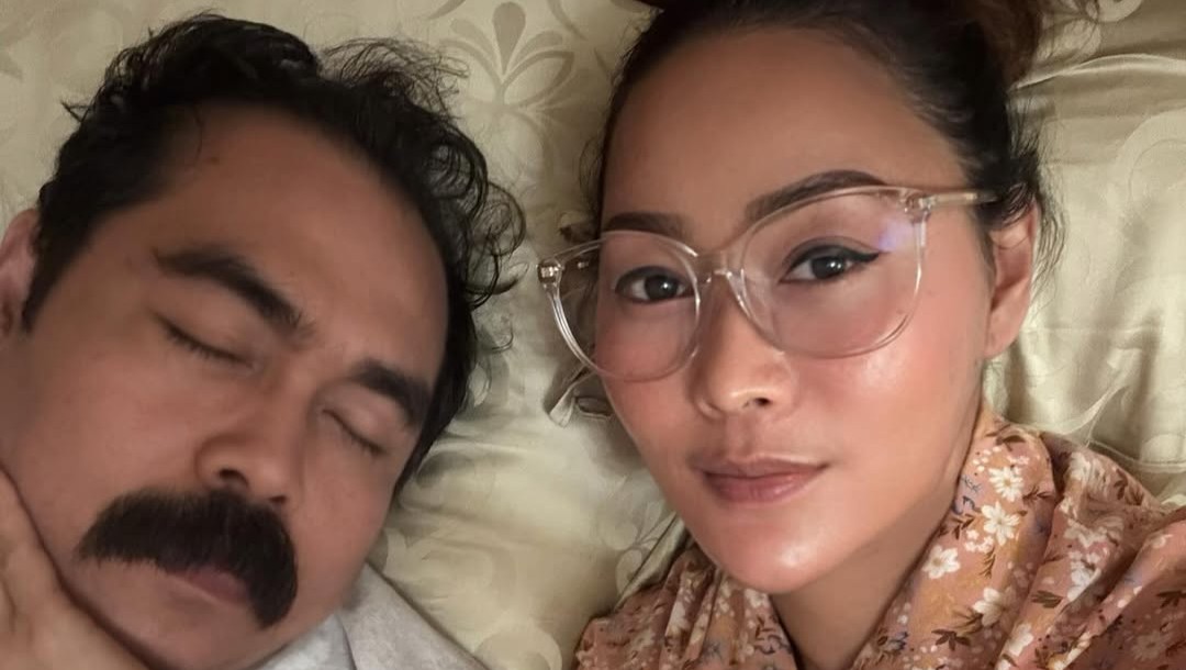 Suami Inul Daratista, Adam Suseno menjalani pemulihan usai kecelakaan di rumahnya