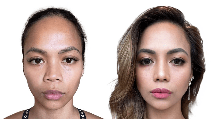 Setiap hasil operasi di JW Hospital didesain sebagai karya seni yang unik dan personal. Karena tidak ada satu hasil yang sama, seluruh prosedur disesuaikan dengan karakteristik dan kebutuhan pasien.