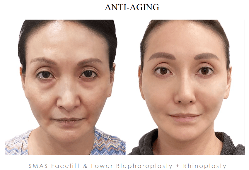 JW Hospital bangga dengan rekam jejak keselamatan 100%, menjadikannya salah satu institusi medis dengan standar keamanan tertinggi di dunia.