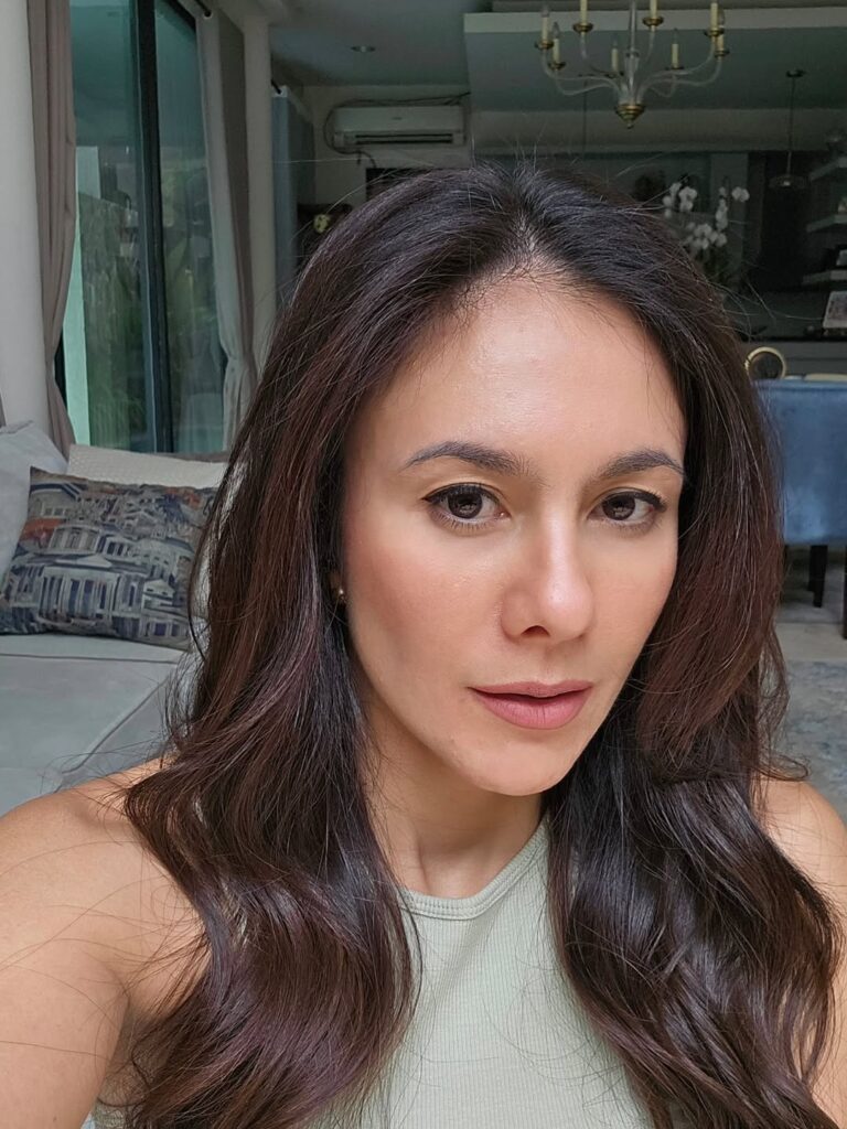 Wulan Guritno tidak tinggal diam menghadapi kondisi kulitnya. Ia telah mencoba berbagai metode perawatan, mulai dari laser, suntikan, subsisi, hingga tetes-tetes kimia.