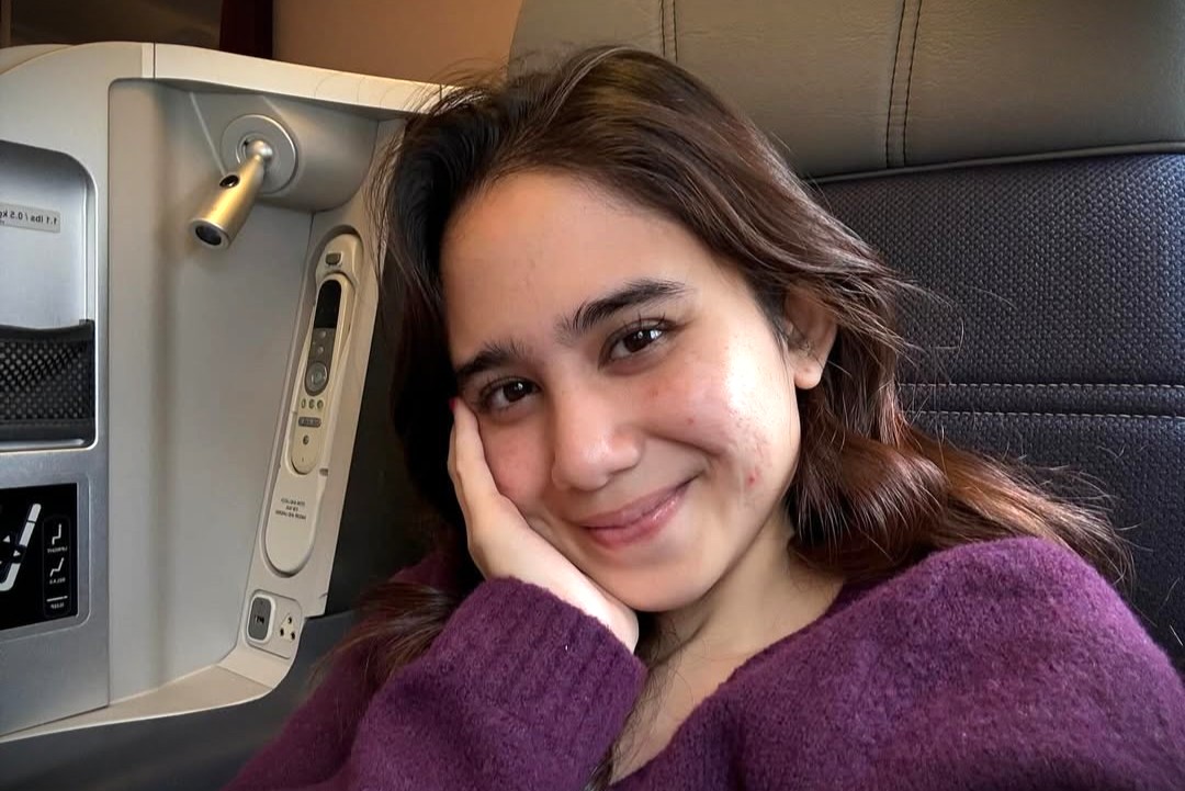 Tissa Biani tak takut jerawat