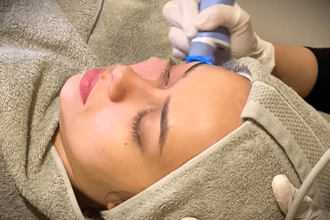 Exion, sebuah treatment yang tersedia di Dermalogia Jakarta