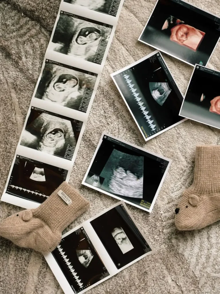 Ia menambahkan bahwa tahun ini terasa sangat istimewa karena mereka akan menyambut buah hati pertama.